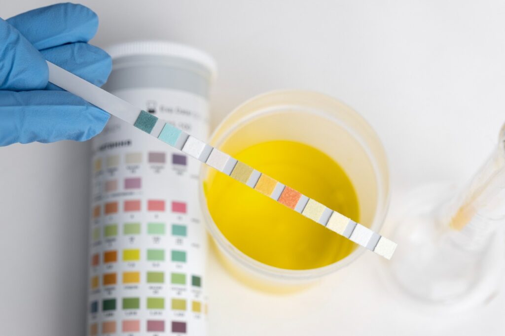 The Role of Synthetic Urine in the Drug Test