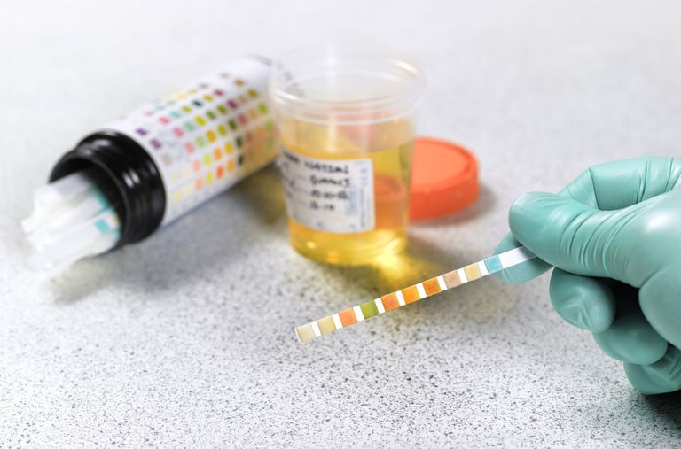 Why Companies Perform Random Drug Testing